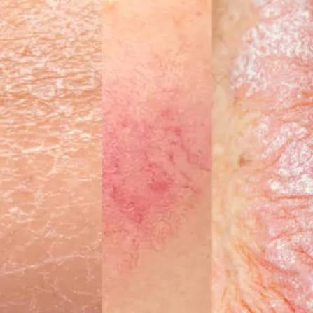 Comment réparer sa peau après l’été ?